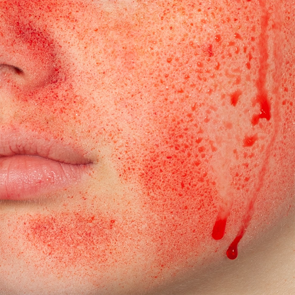 BLOOD POWDER
